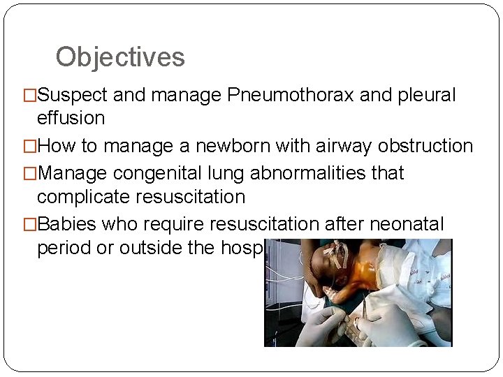 Objectives �Suspect and manage Pneumothorax and pleural effusion �How to manage a newborn with