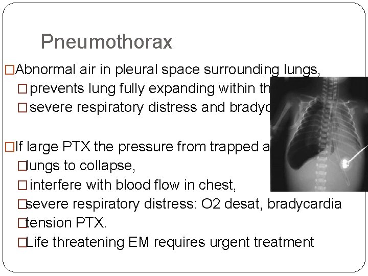 Pneumothorax �Abnormal air in pleural space surrounding lungs, � prevents lung fully expanding within