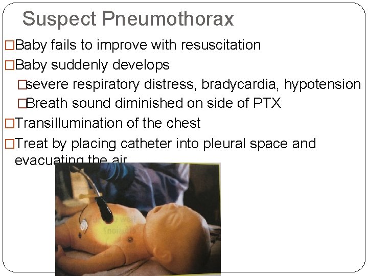 Suspect Pneumothorax �Baby fails to improve with resuscitation �Baby suddenly develops �severe respiratory distress,