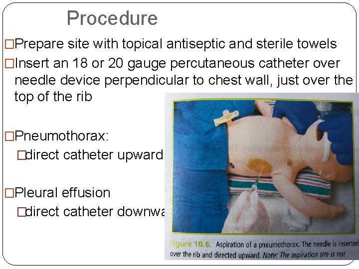 Procedure �Prepare site with topical antiseptic and sterile towels �Insert an 18 or 20
