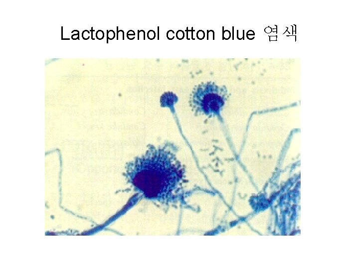 Lactophenol cotton blue 염색 