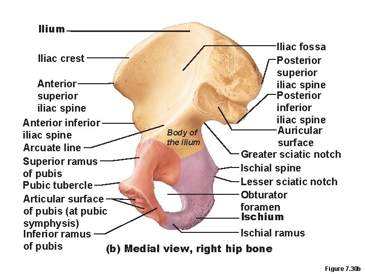 Ilium Iliac crest Iliac fossa Posterior superior iliac spine Posterior inferior iliac spine Auricular