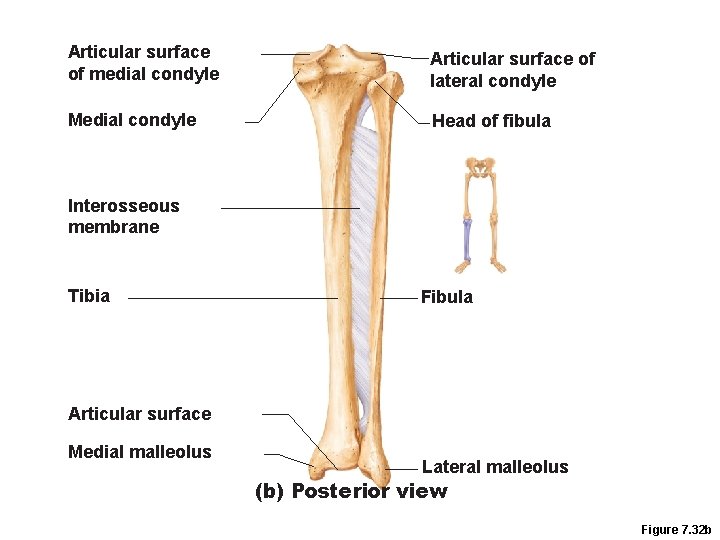 Articular surface of medial condyle Articular surface of lateral condyle Medial condyle Head of