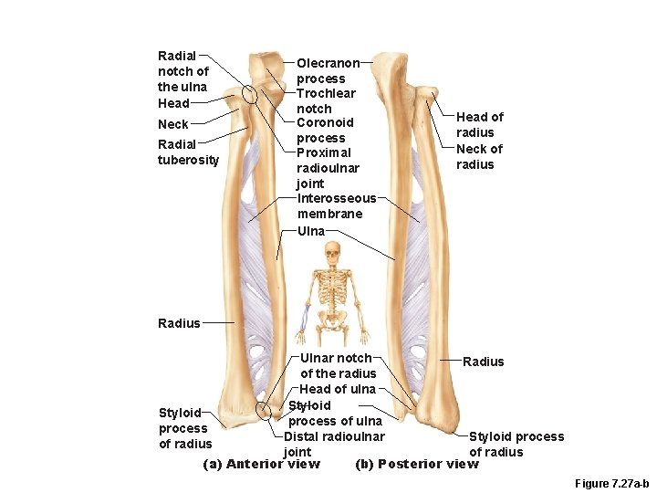 Radial notch of the ulna Head Neck Radial tuberosity Olecranon process Trochlear notch Coronoid