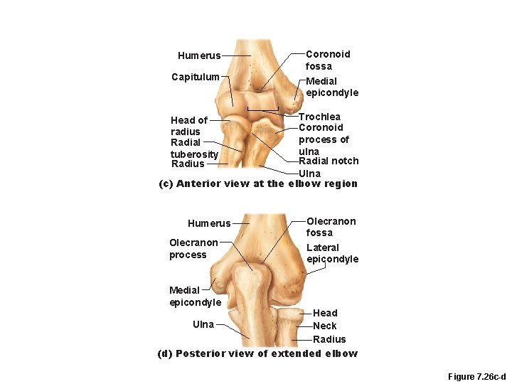 Humerus Capitulum Coronoid fossa Medial epicondyle Trochlea Coronoid process of ulna Radial notch Ulna