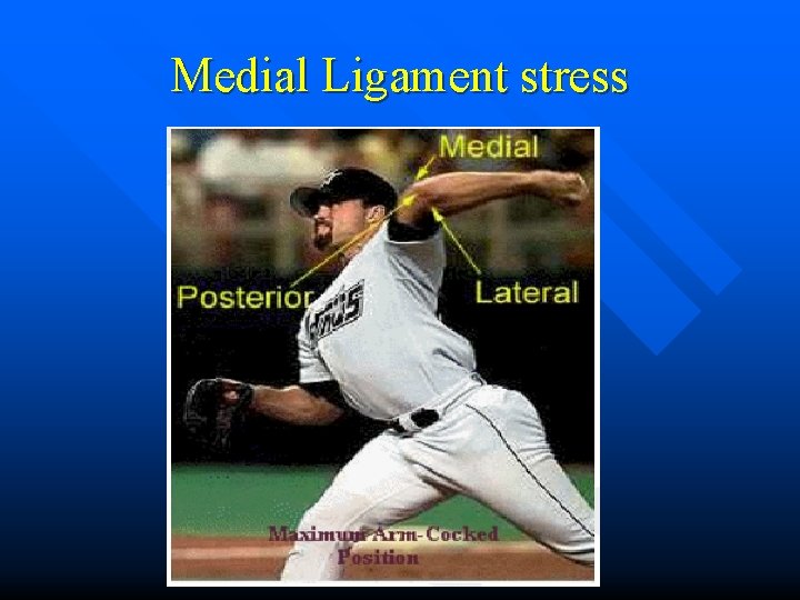 Medial Ligament stress 