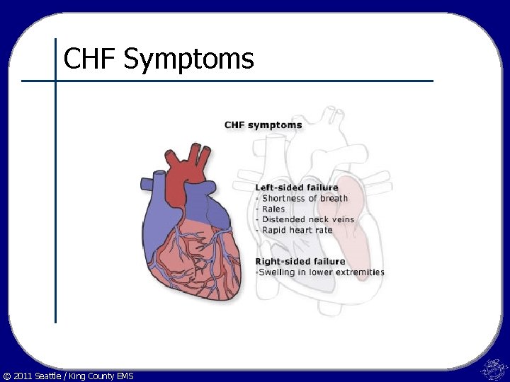 CHF Symptoms © 2011 Seattle / King County EMS 