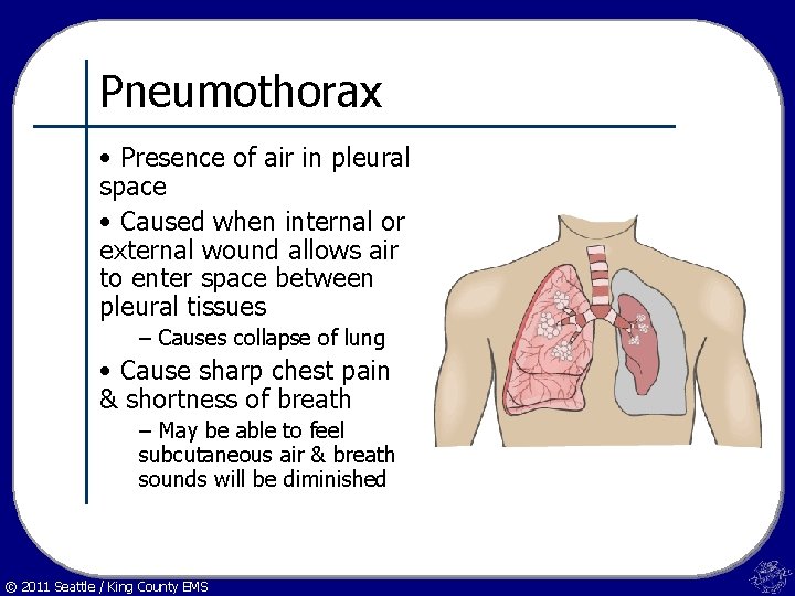 Pneumothorax • Presence of air in pleural space • Caused when internal or external