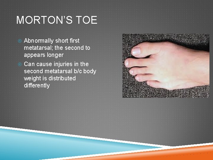 MORTON’S TOE Abnormally short first metatarsal; the second to appears longer Can cause injuries