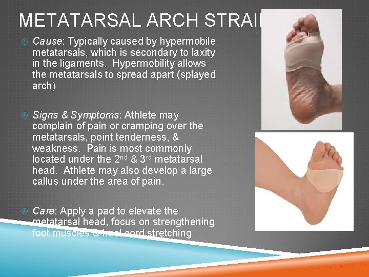 METATARSAL ARCH STRAIN Cause: Typically caused by hypermobile metatarsals, which is secondary to laxity