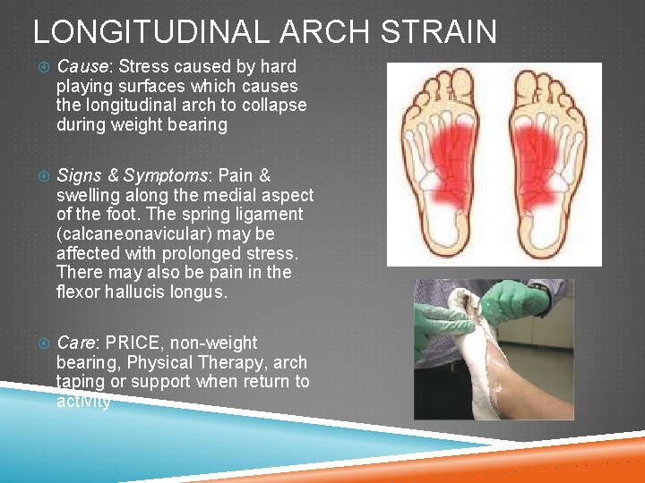 LONGITUDINAL ARCH STRAIN Cause: Stress caused by hard playing surfaces which causes the longitudinal