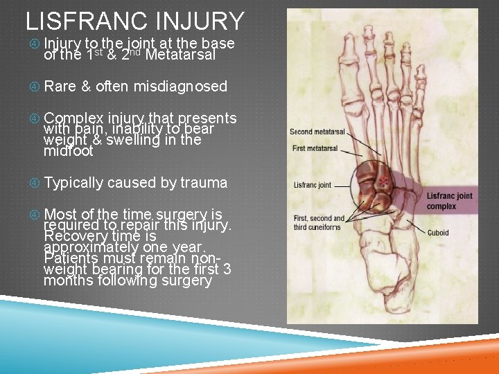 LISFRANC INJURY Injury tostthe joint at the base nd of the 1 & 2