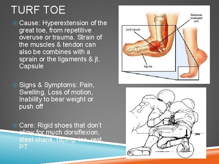 TURF TOE Cause: Hyperextension of the great toe, from repetitive overuse or trauma. Strain