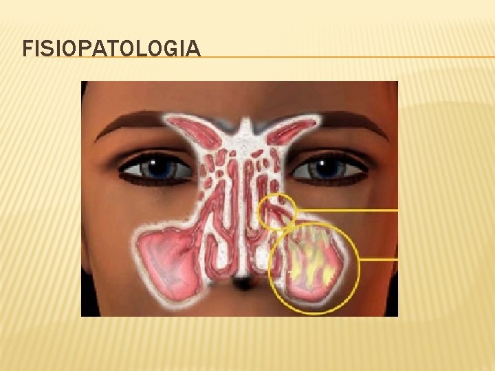 FISIOPATOLOGIA 