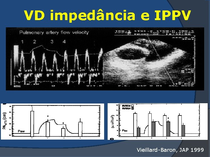 VD impedância e IPPV Vieillard-Baron, JAP 1999 