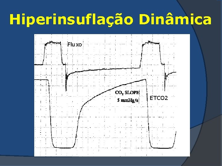 Hiperinsuflação Dinâmica Fluxo ETCO 2 