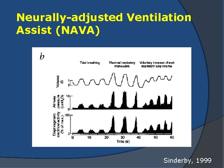 Neurally-adjusted Ventilation Assist (NAVA) Sinderby, 1999 