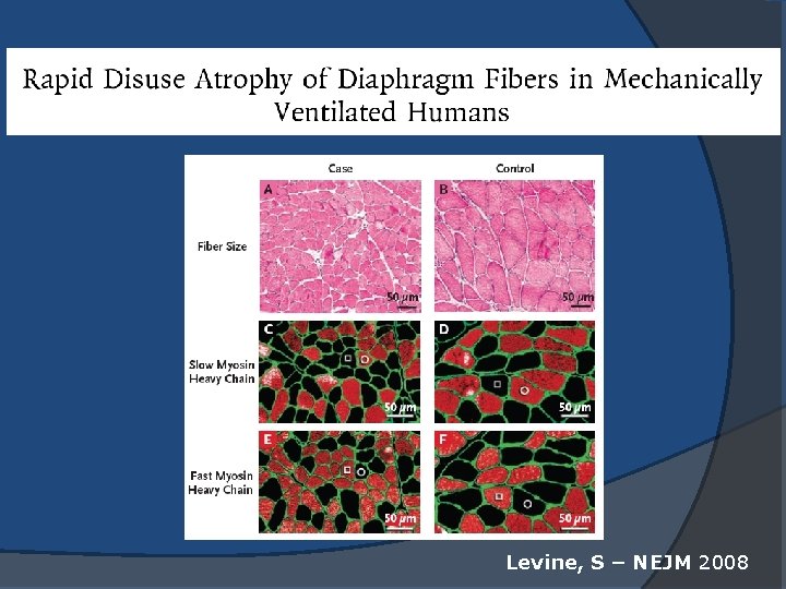 Levine, S – NEJM 2008 