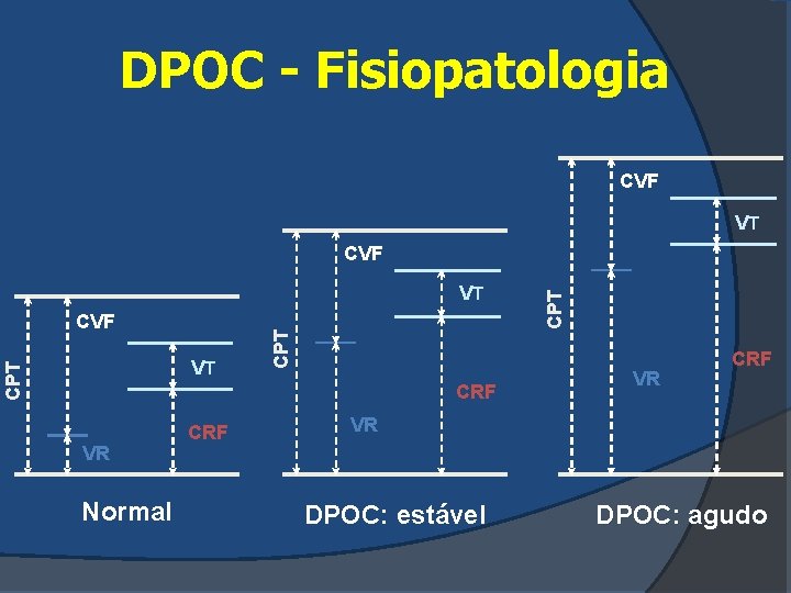 DPOC - Fisiopatologia CVF VT CVF CPT VT CRF VR Normal CRF CPT CVF