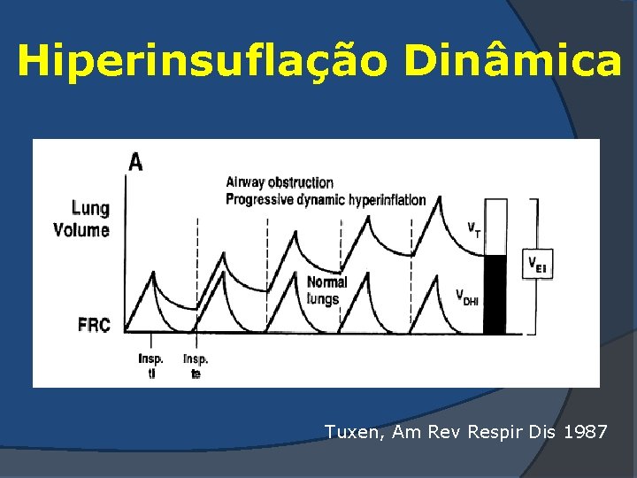 Hiperinsuflação Dinâmica Tuxen, Am Rev Respir Dis 1987 