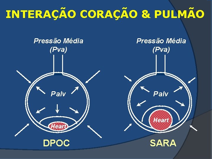 INTERAÇÃO CORAÇÃO & PULMÃO Pressão Média (Pva) P alv Heart DPOC Heart SARA 