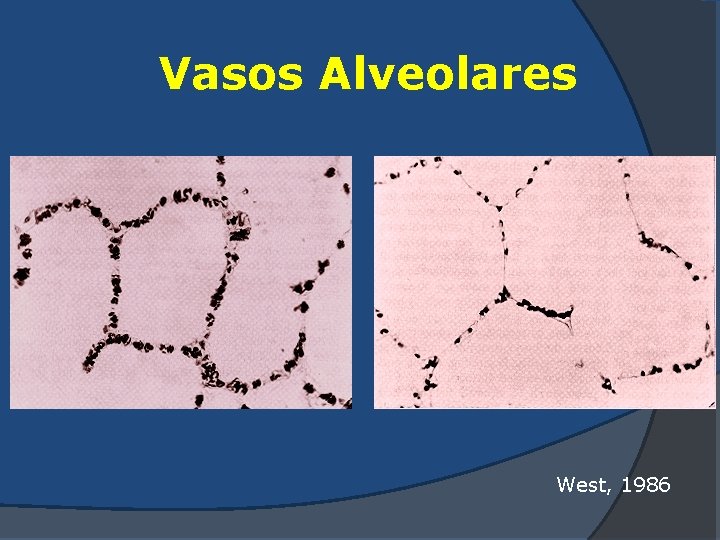 Vasos Alveolares West, 1986 