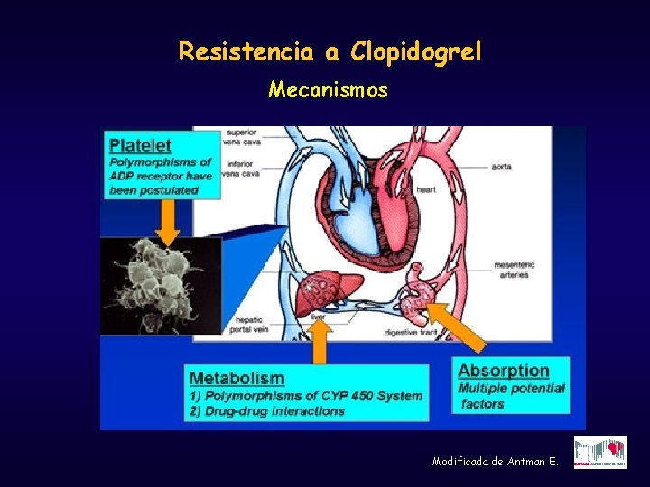 Resistencia a Clopidogrel Mecanismos Modificada de Antman E. 