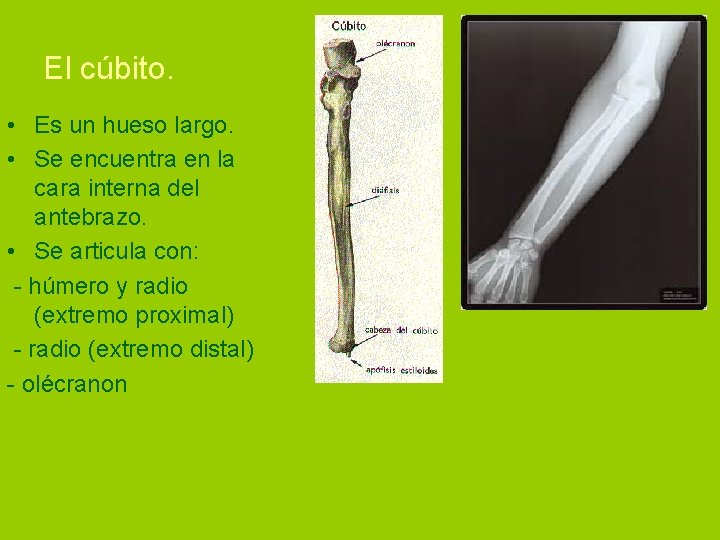 El cúbito. • Es un hueso largo. • Se encuentra en la cara interna