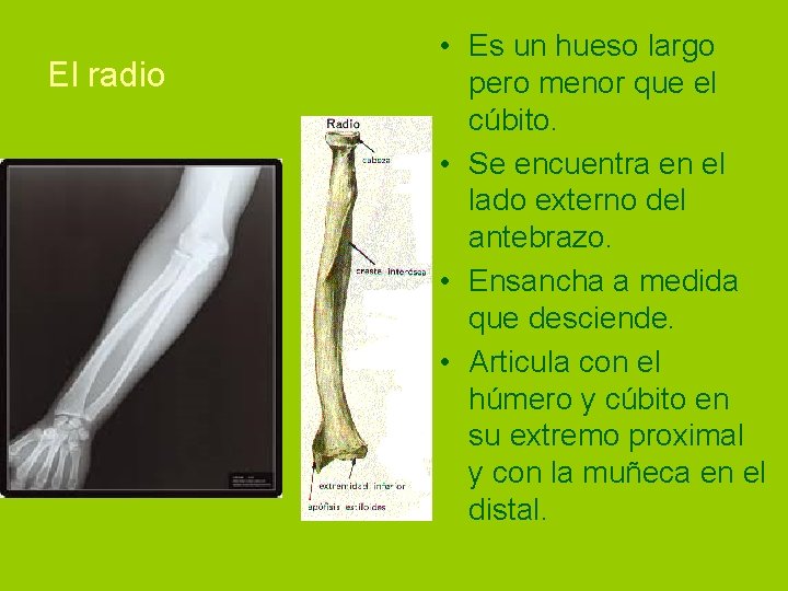 El radio • Es un hueso largo pero menor que el cúbito. • Se