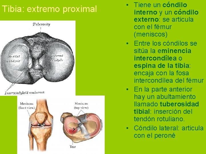 Tibia: extremo proximal • Tiene un cóndilo interno y un cóndilo externo: se articula