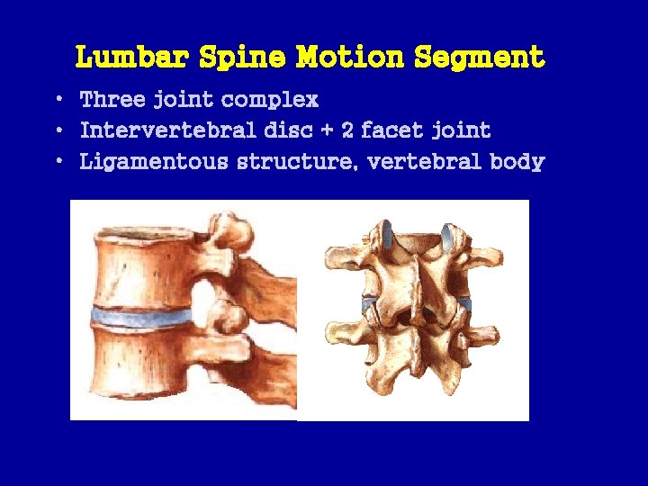 Lumbar Spine Motion Segment • Three joint complex • Intervertebral disc + 2 facet
