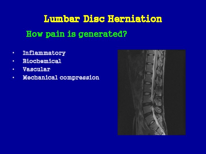 Lumbar Disc Herniation How pain is generated? • • Inflammatory Biochemical Vascular Mechanical compression