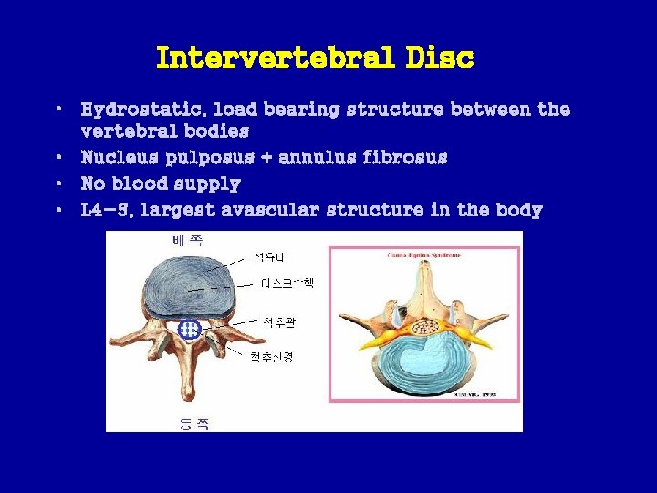 Intervertebral Disc • Hydrostatic, load bearing structure between the vertebral bodies • Nucleus pulposus
