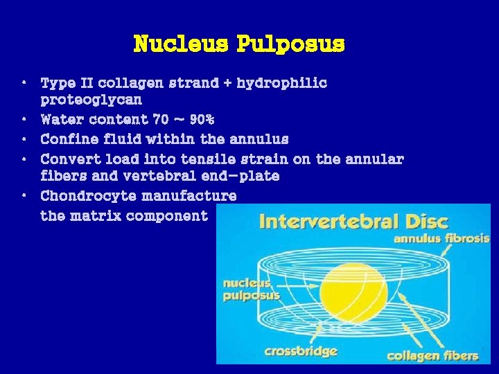 Nucleus Pulposus • Type II collagen strand + hydrophilic proteoglycan • Water content 70
