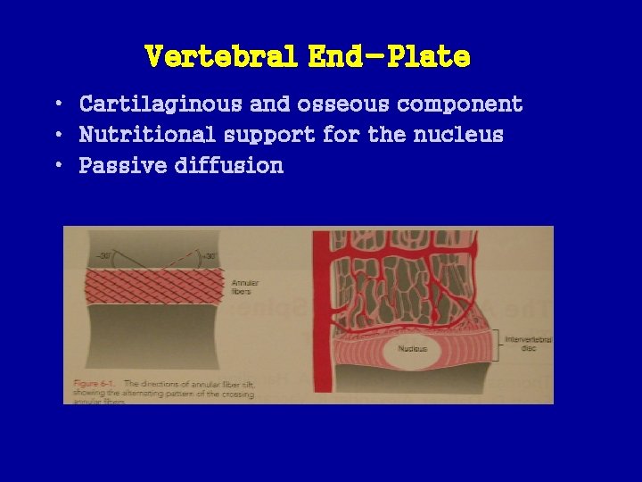 Vertebral End-Plate • Cartilaginous and osseous component • Nutritional support for the nucleus •