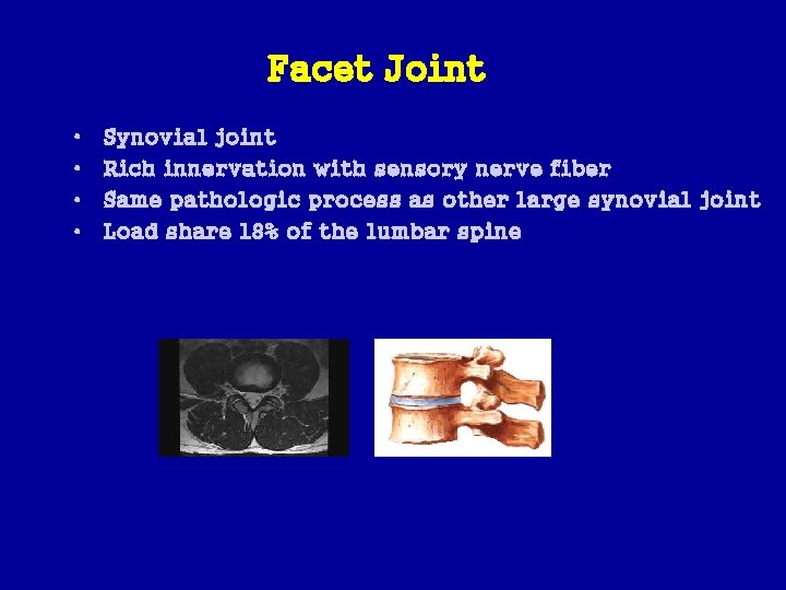 Facet Joint • • Synovial joint Rich innervation with sensory nerve fiber Same pathologic