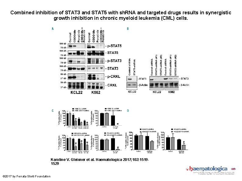 Combined inhibition of STAT 3 and STAT 5 with sh. RNA and targeted drugs