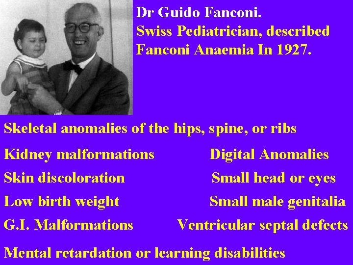 Dr Guido Fanconi. Swiss Pediatrician, described Fanconi Anaemia In 1927. Skeletal anomalies of the