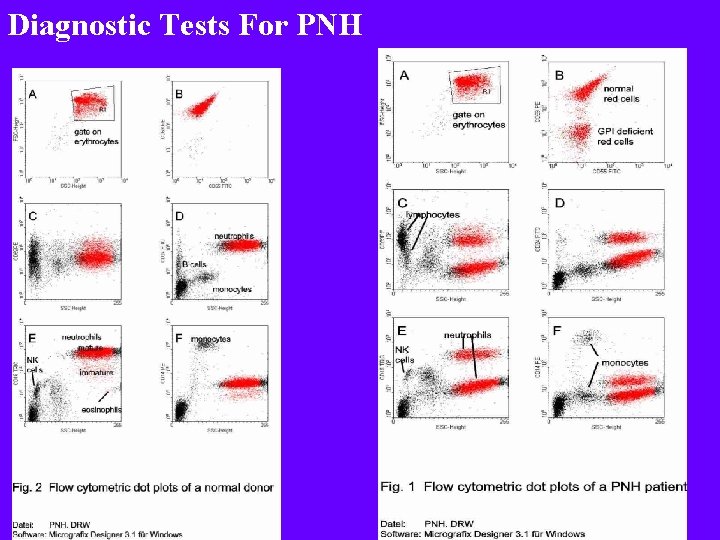 Diagnostic Tests For PNH 