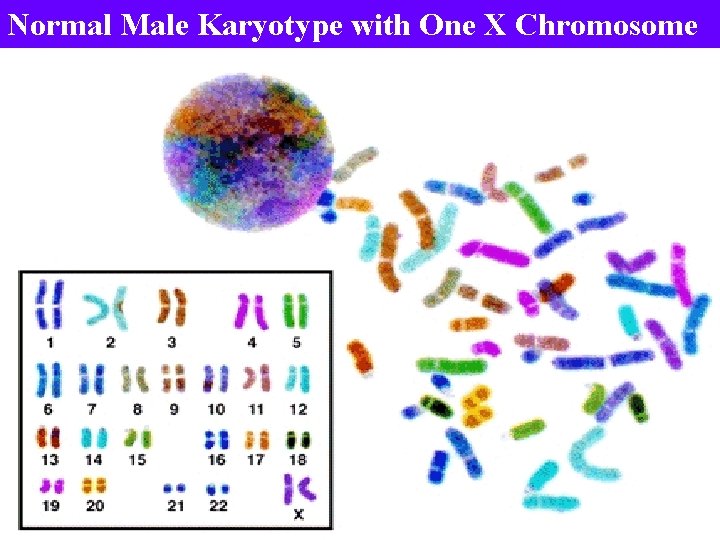 Normal Male Karyotype with One X Chromosome 