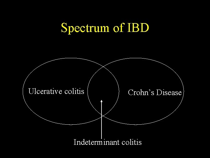 Spectrum of IBD Ulcerative colitis Crohn’s Disease Indeterminant colitis 