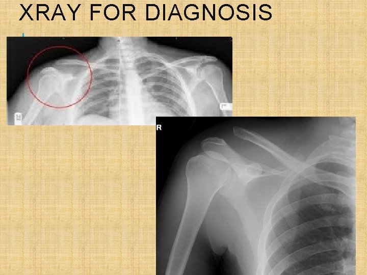 XRAY FOR DIAGNOSIS 