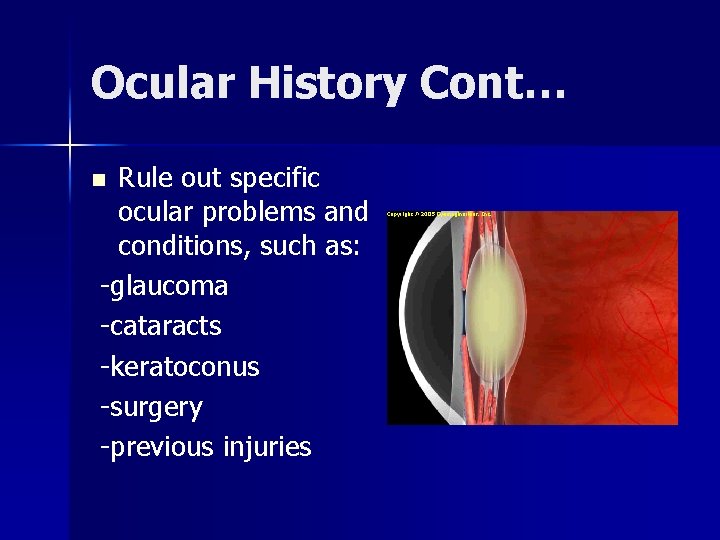 Ocular History Cont… Rule out specific ocular problems and conditions, such as: -glaucoma -cataracts