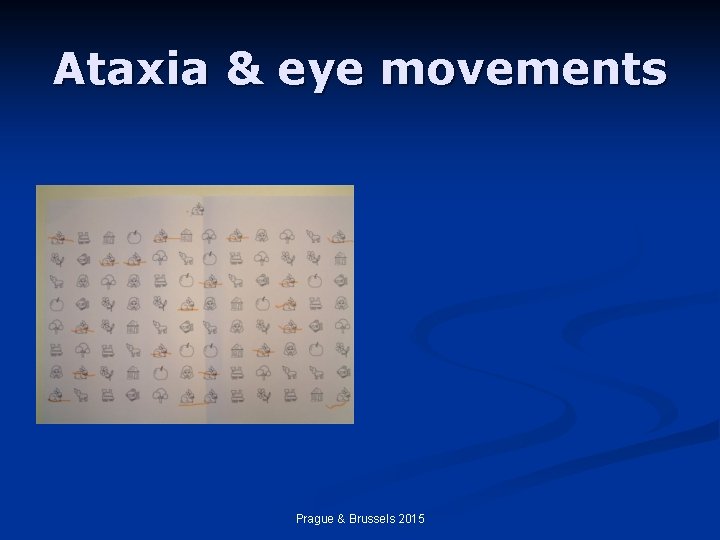 Ataxia & eye movements Prague & Brussels 2015 