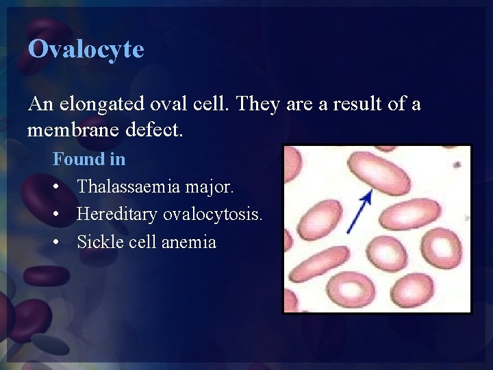 Ovalocyte An elongated oval cell. They are a result of a membrane defect. Found