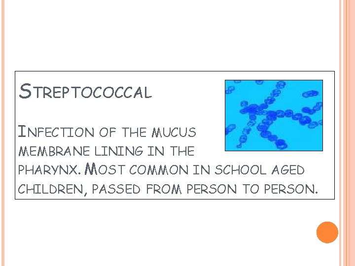 STREPTOCOCCAL INFECTION OF THE MUCUS MEMBRANE LINING IN THE PHARYNX. MOST COMMON IN SCHOOL STREPTOCOCCAL INFECTION OF THE MUCUS MEMBRANE LINING IN THE PHARYNX. MOST COMMON IN SCHOOL