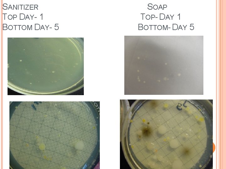 SANITIZER TOP DAY- 1 BOTTOM DAY- 5 SOAP TOP- DAY 1 BOTTOM- DAY 5 SANITIZER TOP DAY- 1 BOTTOM DAY- 5 SOAP TOP- DAY 1 BOTTOM- DAY 5