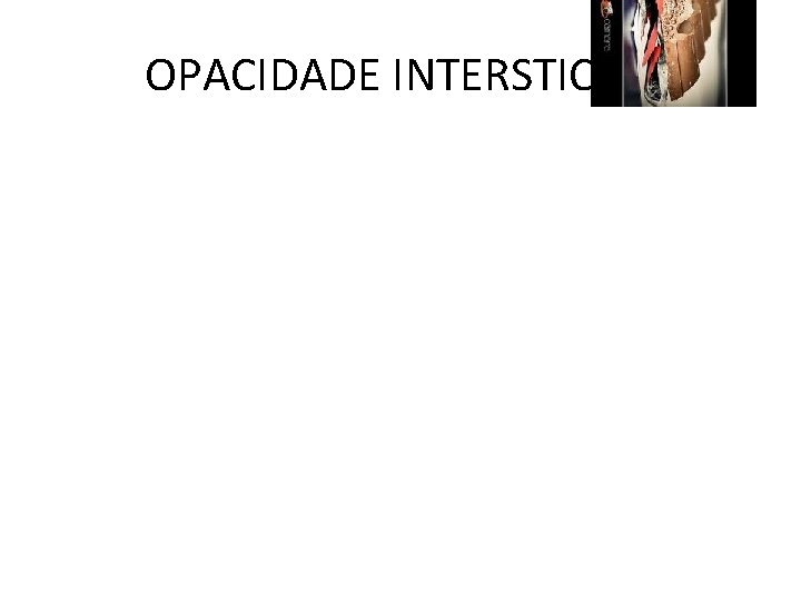 OPACIDADE INTERSTICIAL 