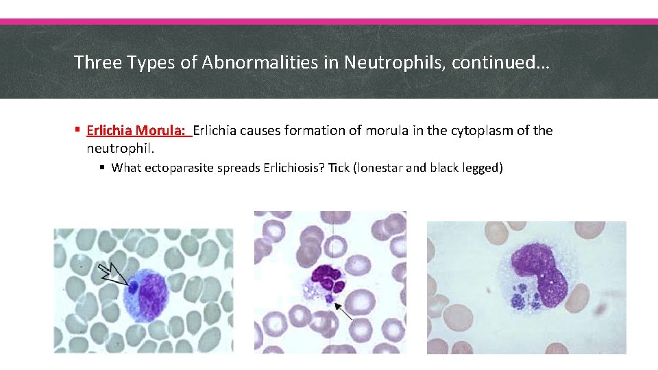 Three Types of Abnormalities in Neutrophils, continued… § Erlichia Morula: Erlichia causes formation of
