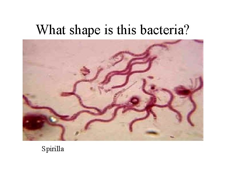 What shape is this bacteria? Spirilla 